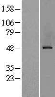AP2M1 Human Over-expression Lysates NM_001025205