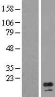 AP1S1 Human Over-expression Lysates NM_057089