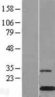 Galectin 10 (CLC) Human Over-expression Lysates NM_001828