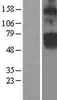 Chloride Channel 5 (CLCN5) Human Over-expression Lysates NM_000084