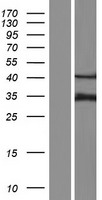 CLCN6 Human Over-expression Lysates NM_021737