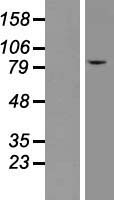 CLC7 (CLCN7) Human Over-expression Lysates NM_001287
