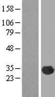 CLIC2 Human Over-expression Lysates NM_001289