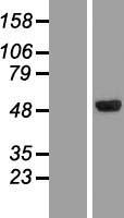CLN5 Human Over-expression Lysates NM_006493