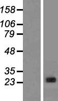 CLNS1A Human Over-expression Lysates NM_001293