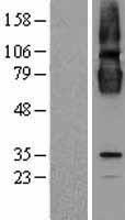 CLPTM1 Human Over-expression Lysates NM_001294