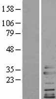 Clathrin light chain (CLTA) Human Over-expression Lysates NM_001833