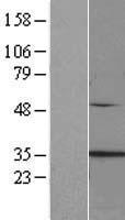 Clathrin light chain (CLTA) Human Over-expression Lysates NM_007096
