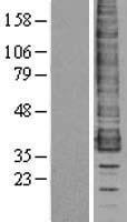 CCR1 Human Over-expression Lysates NM_001295