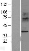 CCR2 Human Over-expression Lysates NM_000648