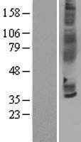 CCR3 Human Over-expression Lysates NM_178329