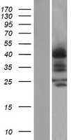 CCR4 Human Over-expression Lysates NM_005508