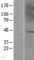 CCR6 Human Over-expression Lysates NM_031409