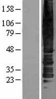 Chemokine Receptor D6 (ACKR2) Human Over-expression Lysates NM_001296