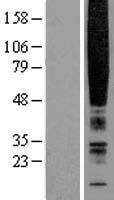 CMKLR1 Human Over-expression Lysates NM_004072