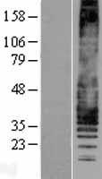 Leukotriene B4 Receptor (LTB4R) Human Over-expression Lysates NM_181657