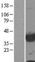 Calponin (CNN1) Human Over-expression Lysates NM_001299