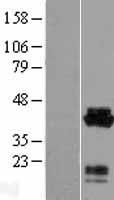 Acidic Calponin (CNN3) Human Over-expression Lysates NM_001839