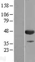 CNPase (CNP) Human Over-expression Lysates NM_033133
