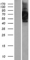 CNTF Receptor alpha (CNTFR) Human Over-expression Lysates NM_147164