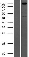 Collagen IV (COL4A2) Human Over-expression Lysates NM_001846