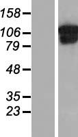 Collagen VI (COL6A1) Human Over-expression Lysates NM_001848