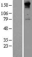 COL8A1 Human Over-expression Lysates NM_001850