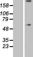 COL8A1 Human Over-expression Lysates NM_020351