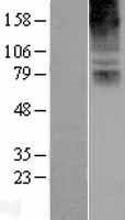 COL8A2 Human Over-expression Lysates NM_005202
