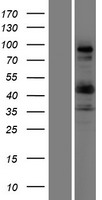 Collagen IX (COL9A1) Human Over-expression Lysates NM_001851