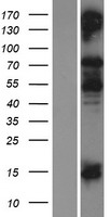 Collagen IX (COL9A1) Human Over-expression Lysates NM_078485