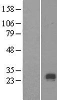 Collagen X (COL10A1) Human Over-expression Lysates NM_000493