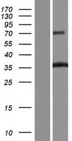 Collagen XI alpha 2 (COL11A2) Human Over-expression Lysates NM_001163771