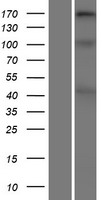 Collagen XI alpha 2 (COL11A2) Human Over-expression Lysates NM_080680