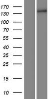 Collagen XV (COL15A1) Human Over-expression Lysates NM_001855