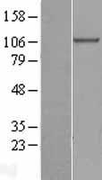 beta COP (COPB1) Human Over-expression Lysates NM_001144062