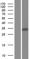 KLF6 Human Over-expression Lysates NM_001160125