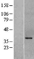 KLF6 Human Over-expression Lysates NM_001300