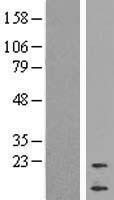 Cortistatin (CORT) Human Over-expression Lysates NM_001302