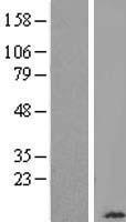Cytochrome C Oxidase subunit VIb (COX6B1) Human Over-expression Lysates NM_001863