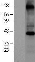 COX10 Human Over-expression Lysates NM_001303