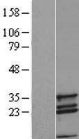 COX11 Human Over-expression Lysates NM_004375