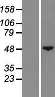 Carboxypeptidase A (CPA1) Human Over-expression Lysates NM_001868