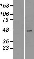 Carboxypeptidase A2 (CPA2) Human Over-expression Lysates NM_001869