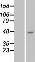 Carboxypeptidase B (CPB1) Human Over-expression Lysates NM_001871
