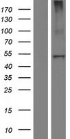 Carboxypeptidase B2 (CPB2) Human Over-expression Lysates NM_001872