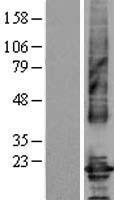 Claudin 4 (CLDN4) Human Over-expression Lysates NM_001305