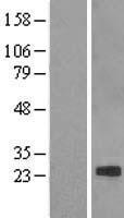 ls001366 claudin 7 cldn7 human over expression lysates nm 001307 wb testing 2