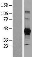 Carboxypeptidase M (CPM) Human Over-expression Lysates NM_001874
