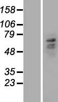 Carboxypeptidase M (CPM) Human Over-expression Lysates NM_198320